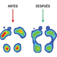 Smou Meta Plantilla con Descarga Metatarsal 35/36 1 Par