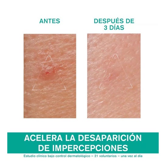 URIAGE Hyséac Pate SOS 15g URIAGE Hyséac Pate SOS 15g