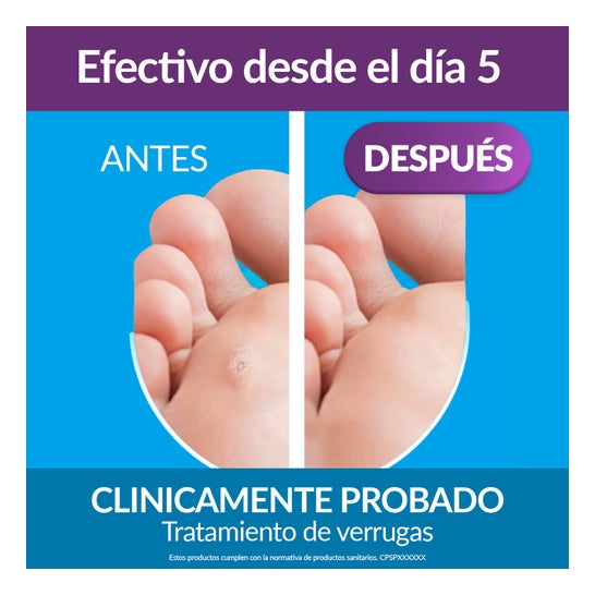 Excilor Verrugas Duo Power 10ml Crio + 1,5g Ácido