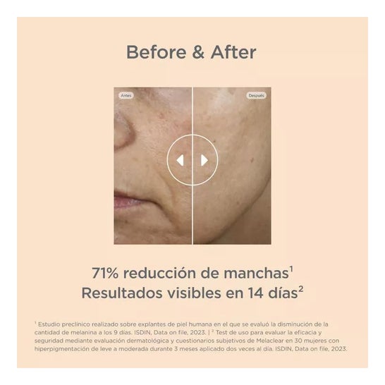 Isdin Isdinceutics Melaclear Refill 30ml Isdin Isdinceutics Melaclear Refill 30ml