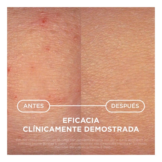 Bioderma Atoderm Intensive Baume Bálsamo Ultracalmante 75ml