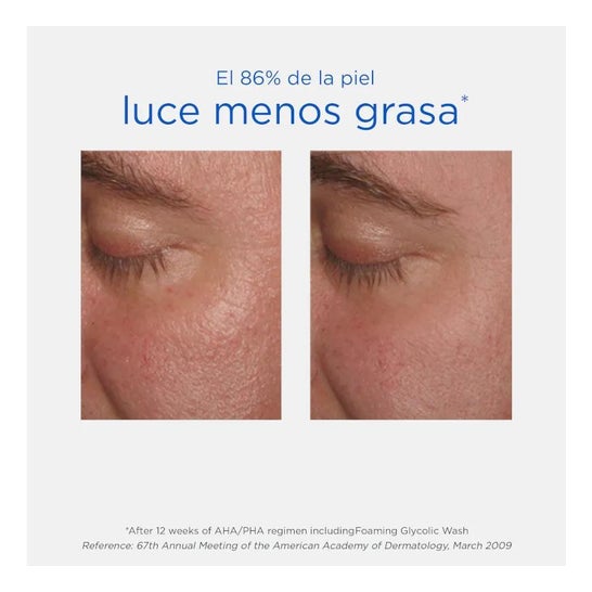 NeoStrata® Resurface renseskum 100ml NeoStrata® Resurface renseskum 100ml