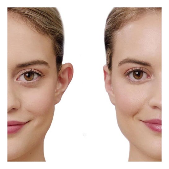 Otostick concealer dreng ører 8uds Otostick concealer dreng ører 8uds