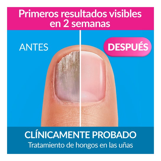 Excilor Oplossing Xl Formaat 7ml
