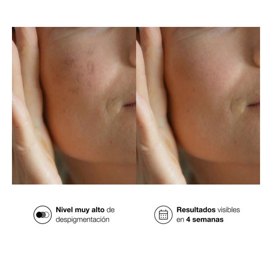 Bella Aurora Bio10 Forte M-Lasma Despigmentante 30ml