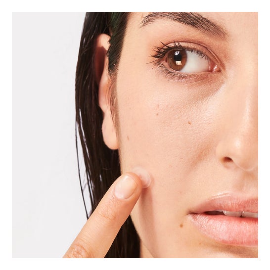 Iroha Nature Parches SOS Granos para Acné Cara y Cuerpo 18uds