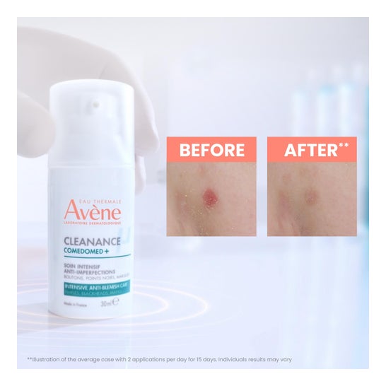 Avene Cleanance Comedomed+ Concentrado Anti-Imperfecciones 30ml