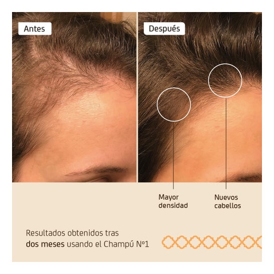 Nuggela & Sulé Champú nº1 Fuerza y Volumen Cebolla Viaje 100 ml