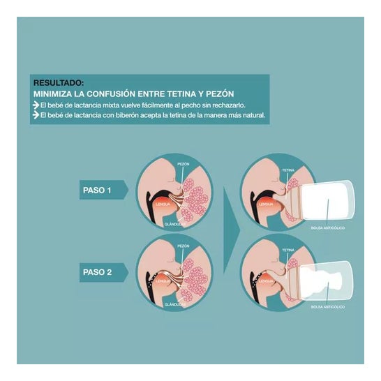 Suavinex Biberon Zero Colico Sauger Adapt Baby Stärke 180ml Suavinex Biberon Zero Colico Sauger Adapt Baby Stärke 180ml