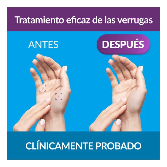 Excilor Gel Antiverrugas 4ml