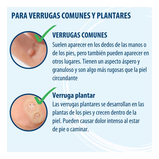 Evolsin Bolígrafo contra las Verrugas 3ml