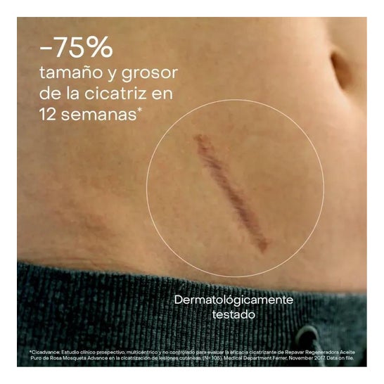 Repavar Advance Reines Wildrosenöl 15 ml Repavar Advance Reines Wildrosenöl 15 ml