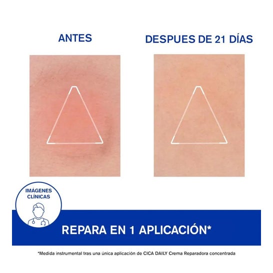 Uriage Bariderm Cica Daily Moisturising Gel Cream 40ml Uriage Bariderm Cica Daily Moisturising Gel Cream 40ml