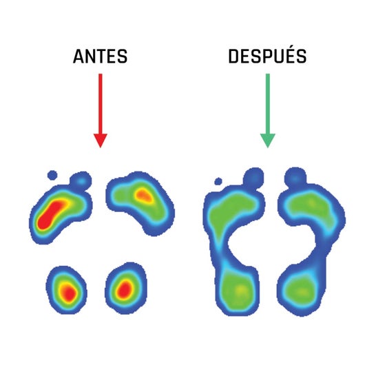 Smou Meta Metatarsalgia Amortiguación y Confort Talla 35-36 1 par Smou Meta Metatarsalgia Amortiguación y Confort Talla 35-36 1 par