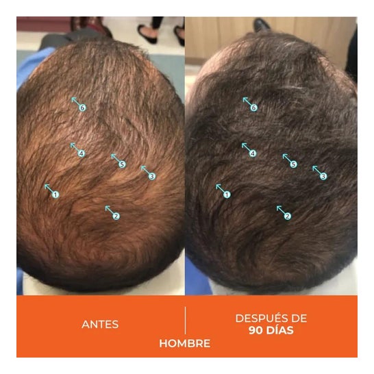 Revita Anticaída Capilar 30caps Revita Anticaída Capilar 30caps