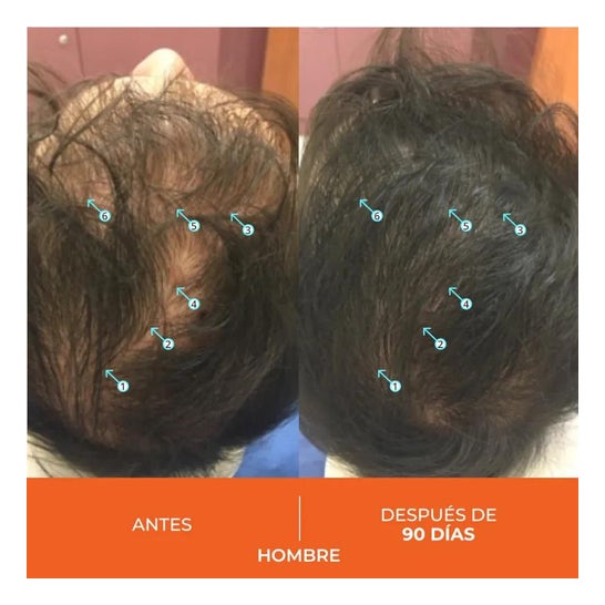 Revita Anticaída Capilar 30caps Revita Anticaída Capilar 30caps