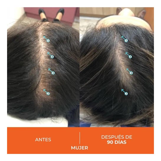 Revita Anticaída Capilar 30caps Revita Anticaída Capilar 30caps