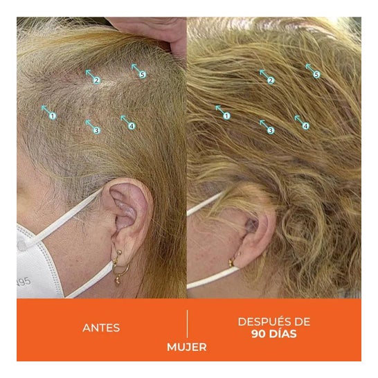 Revita Anticaída Capilar 30caps Revita Anticaída Capilar 30caps