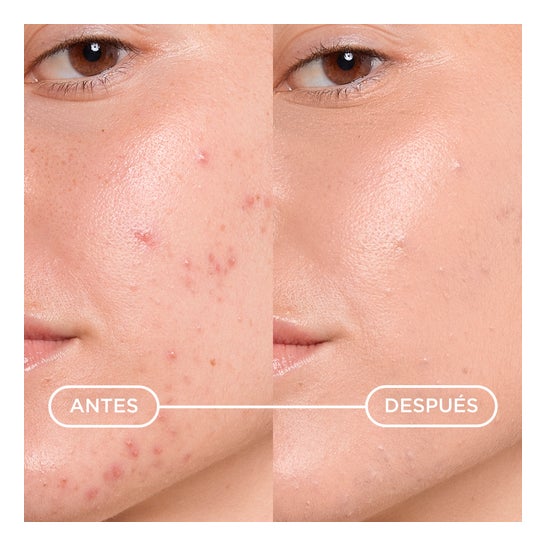 Sébium Kerato + Cover 30 ml