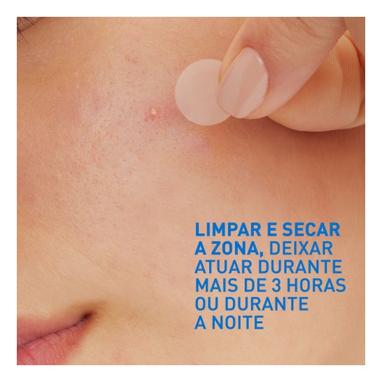 CeraVe Parches Control Imperfecciones 22 parches