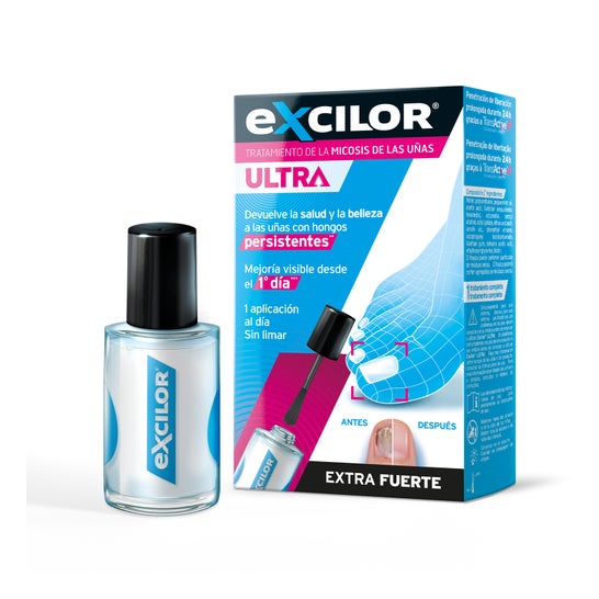 Excilor Ultra Solution 30ml