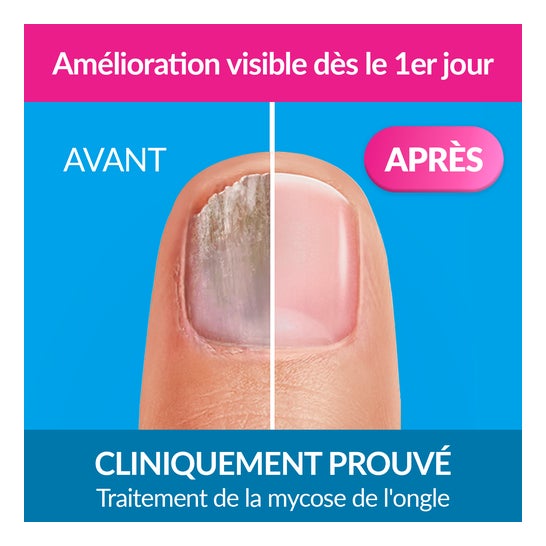 Excilor Forte Nagelpilzbehandlung 30 ml
