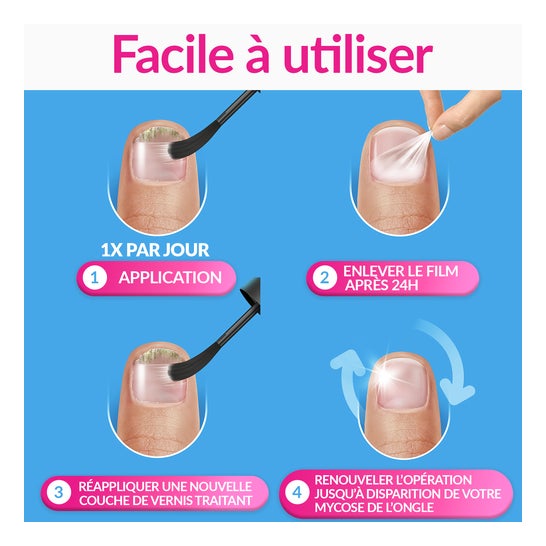 Excilor Forte Nagelpilzbehandlung 30 ml