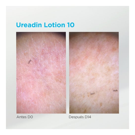 Ureadin® Hydration Loción 10% Urea 1l