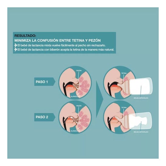 Suavinex Zero-Zero Biberón Anticólico Silicona 1ud Suavinex Zero-Zero Biberón Anticólico Silicona 1ud