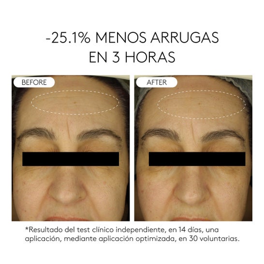 Cocunat Clinical Beauty Filler Duo 5 x 2 ml