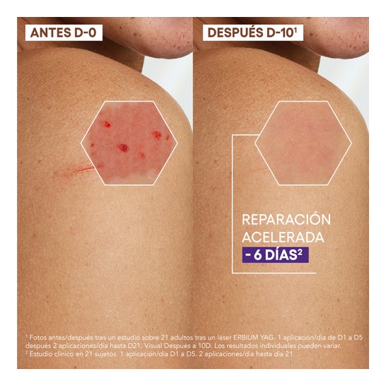 A-Derma Epitheliale Ultra Repair Crema Reparadora 40ml