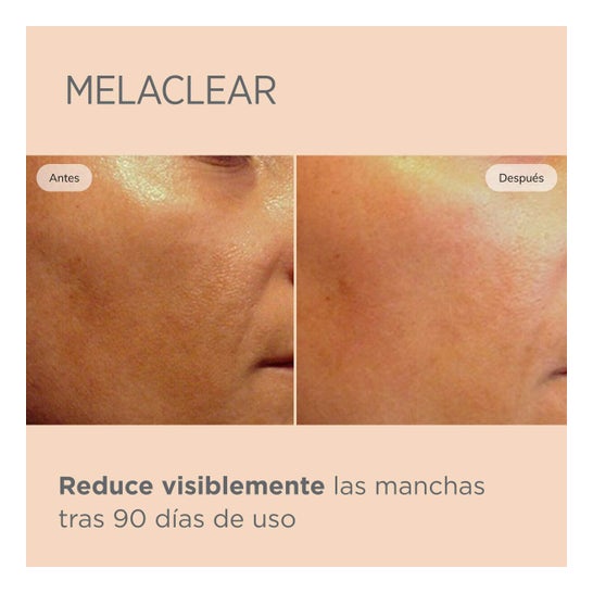 ISDIN Isdinceutics Melaclear Sérum 15ml