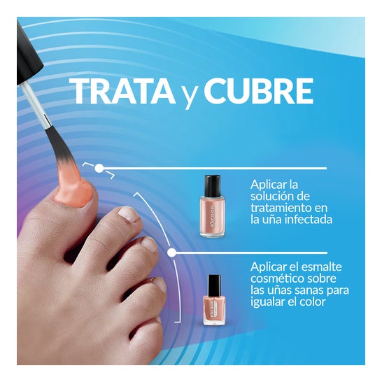 Excilor Forte Color Tratamiento de Hongos de Uñas Nude 30ml