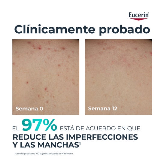 Eucerin DermoPure Clinical Crema Corporal Correctora 200ml
