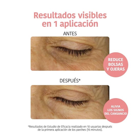 Iroha Nature Parches Anti-fatiga Iluminadores Vitamina C 2uds Iroha Nature Parches Anti-fatiga Iluminadores Vitamina C 2uds