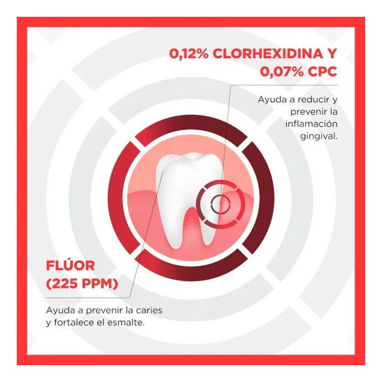 Parogencyl Forte colutorio 300ml Parogencyl Forte colutorio 300ml