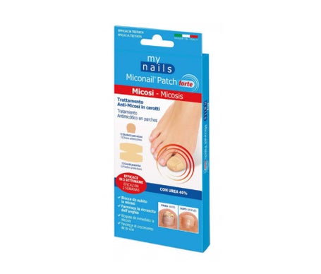 My Nails Patch Forte 12uds + 12uds