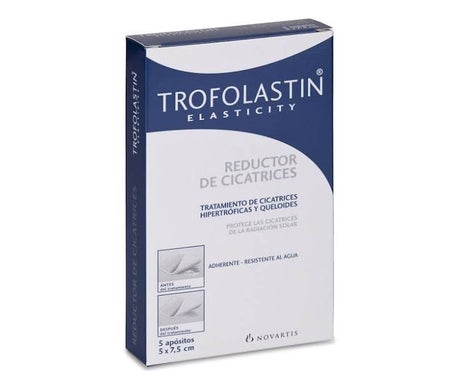 Trofolastín® Pflaster zur Narbenreduktion 5x7,5cm 5 Stück