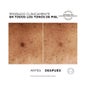 L'Oréal Bright Reveal Niacinamide Serum Dark Spots 30 ml