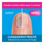 Excilor® Lack gegen Nagelpilz 3,3ml