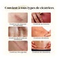Dermatix Gel Tubo 60G