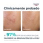 Eucerin DermoPure Clinical Peeling 10 40ml