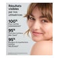 Acm Acéane Crema Ácido Azelaico 15% 30ml