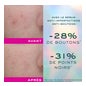 Nuxe Zinc Power Sérum Anti-Imperfections Et Anti-Boutons 30ml