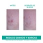 Uriage Hyséac 3-Regul Rundumpflege 40 ml