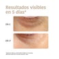 Iroha Nature Global Eye Care Parches Niacinamida Cafeína y Péptidos 2x8ml